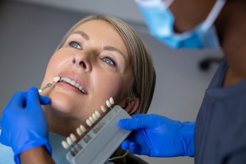 dentist holding Porcelain veneers next to patient to find shade match