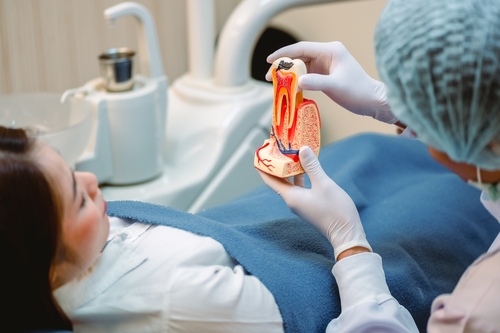 Dentist showing a model of a tooth explaining about a root canal procedure