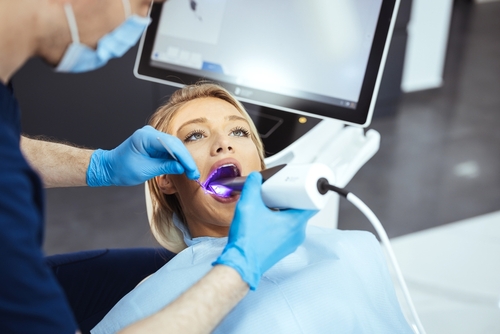 Dental Fillings