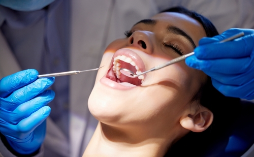dental implants
