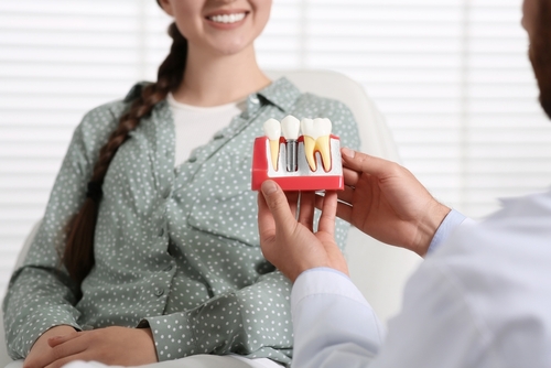 dental implant evaluation