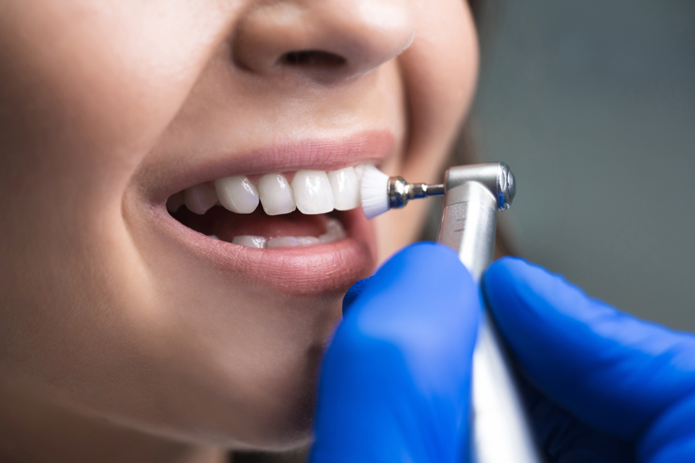 dentist polishing and cleaning teet