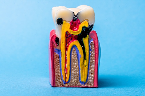 gum disease treatment