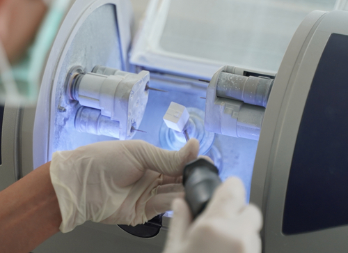 Custom-Fabricated Restorations