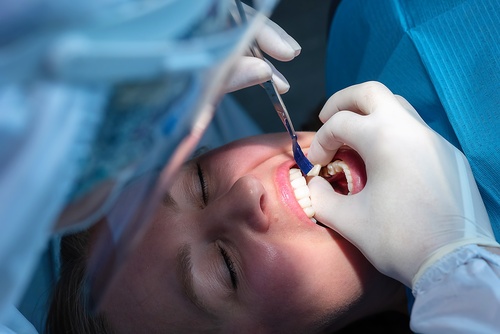 Custom-Fit Restorations