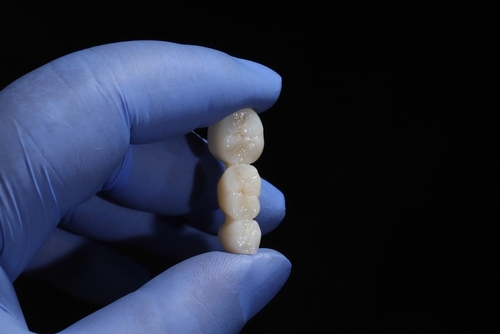 Zirconia Crowns​